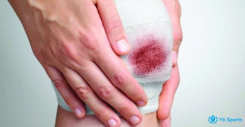 Mơ thấy người khác đánh nhau chảy máu thể hiện cho những mâu thuẫn mà bạn đang gặp phải