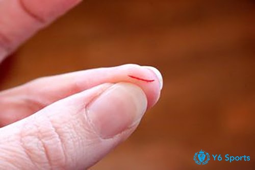 Giải mã giấc mơ thấy chảy máu số mấy mang lại cho bạn nhiều con số may mắn liên quan